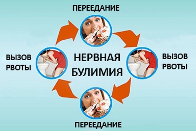 Лечение булимии в Сторожевой
